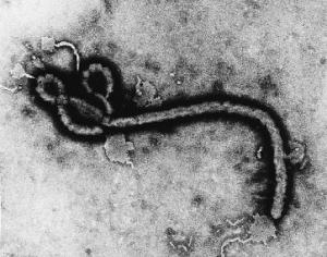 Electron micrograph image of the Ebola virus.